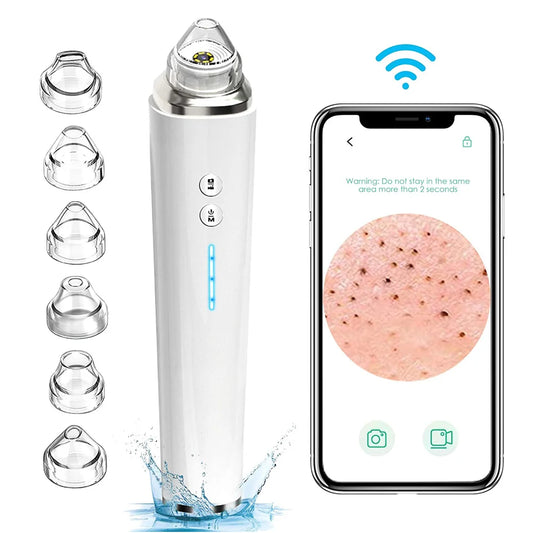 Mychway HD Camera Blackhead Remover With Light For Facial Cleaning